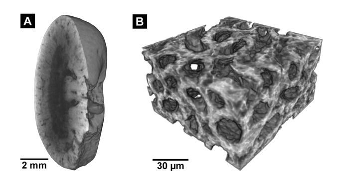 Links: Micro-CT-Aufnahme einer Mausniere, rechts: Nano-CT-Aufnahme des Gewebes.