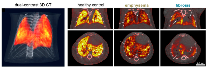 Verschiedene CT-Bilder von Lungenuntersuchungen an Mäusen