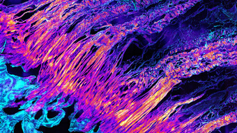 Fluoreszenz-Mikroskopbild des Übergangs von Sehne zu Knochen