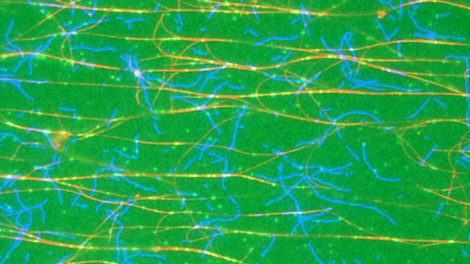 Mikroskopbild des Zytoskeletts einer Zelle.