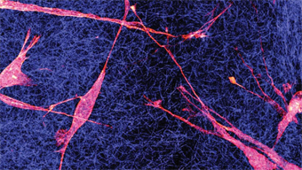  Epithelial cells interact with each other via the extracellular matrix 